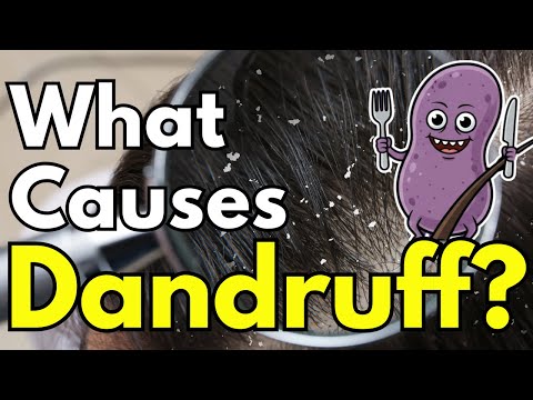 頭皮屑不是不洗頭!真正兇手其實是「他」!(What Causes Dandruff?)