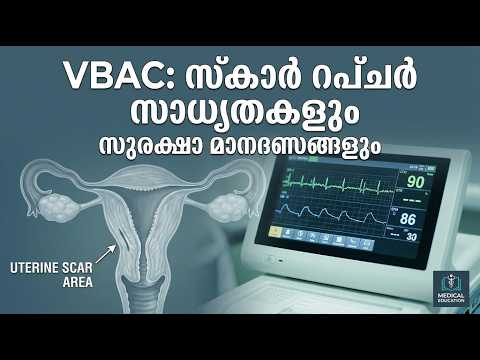 VBAC — video thumbnail