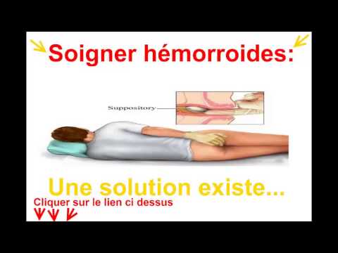 comment soulager hemorroides internes