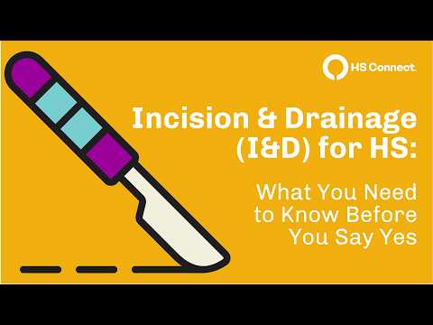 Deroofing versus incision and drainage educational video