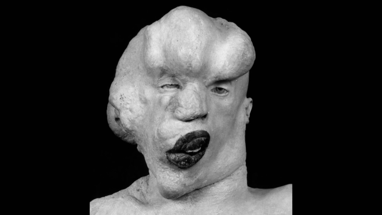 The Elephant Man | Portillo's Hidden History Of Britain