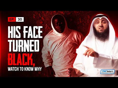 His Face Turned Black, This Is Why | Stories Of Dead People Series | EP30 | S1