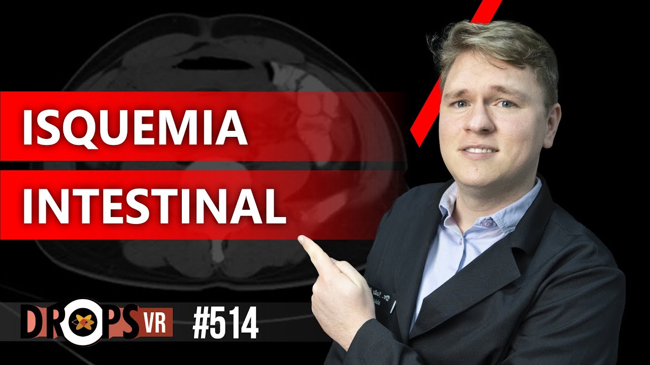 ISQUEMIA INTESTINAL: COMO RECONHECER NA TOMOGRAFIA