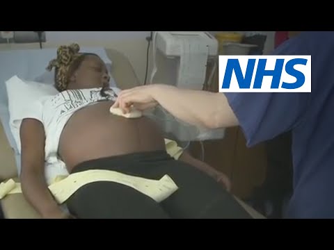 My baby is breech. What help will I get? | NHS