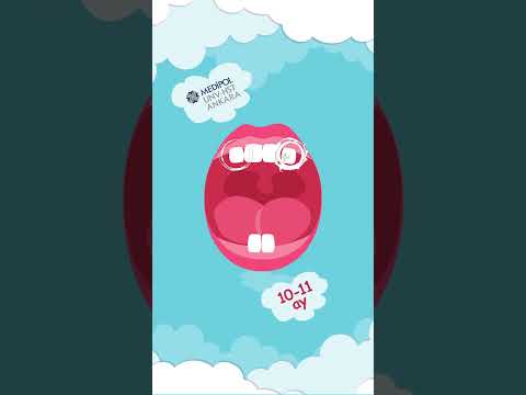 Bebeklerde Diş Çıkarma Belirtileri ve Yapılması Gerekenler