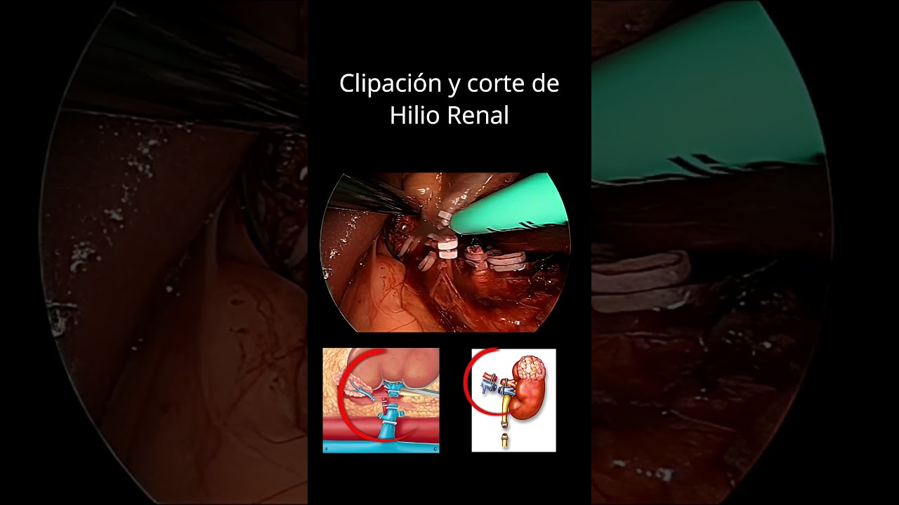 Jorge Alberto Juárez Varela-166