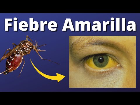 Yellow Fever Explained Clearly