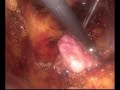 video thumbnail (4)