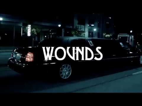 [FREE] 21 Savage x Post Malone type beat "Wounds"