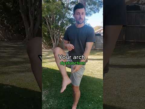 Collapsed Arches Aren't an Arch Problem, They're a LEG Problem