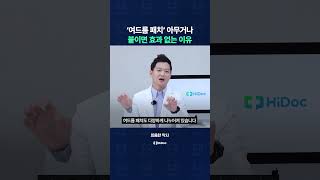 '여드름 패치' 아무거나 붙이면 효과 없는 이유