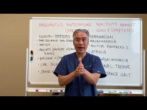 Hashimoto's Autoimmune Reactivity Against Cerebellum (Brain)-Signs and Symptoms. Dizzness? Tremor?