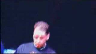 water in my hands - scars of life