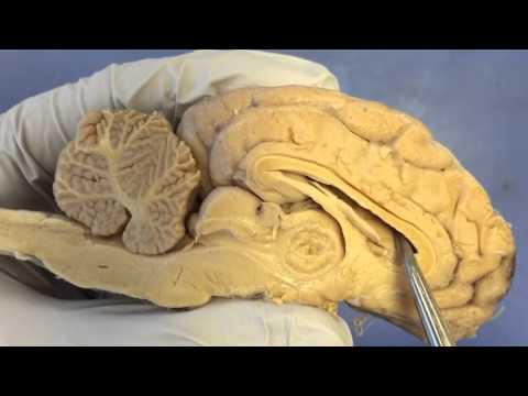 Sheep Brain Anatomy
