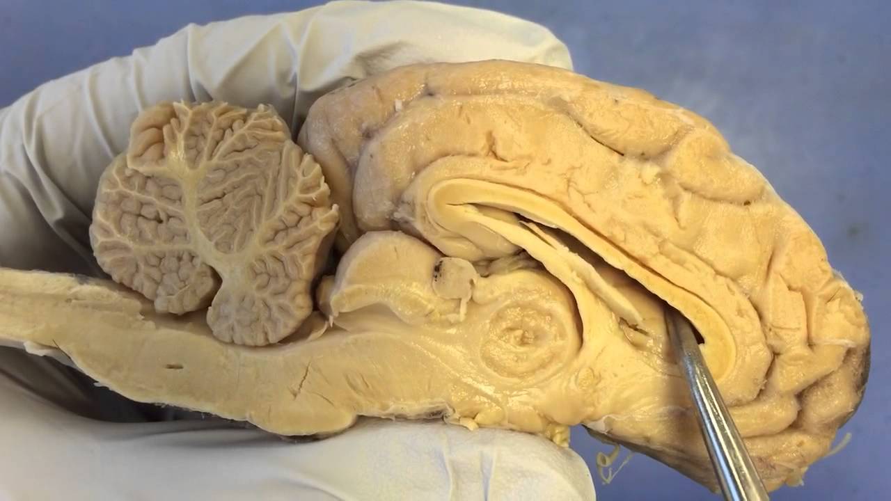 Sheep Brain Anatomy