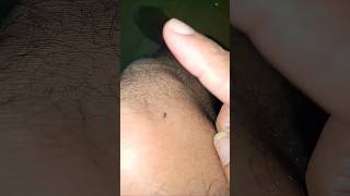 Download lagu ternyata di pagi hari masih ada nyamuk menggigit ku #feedshorts #youtubeshorts #nyamuk #mosquito mp3
