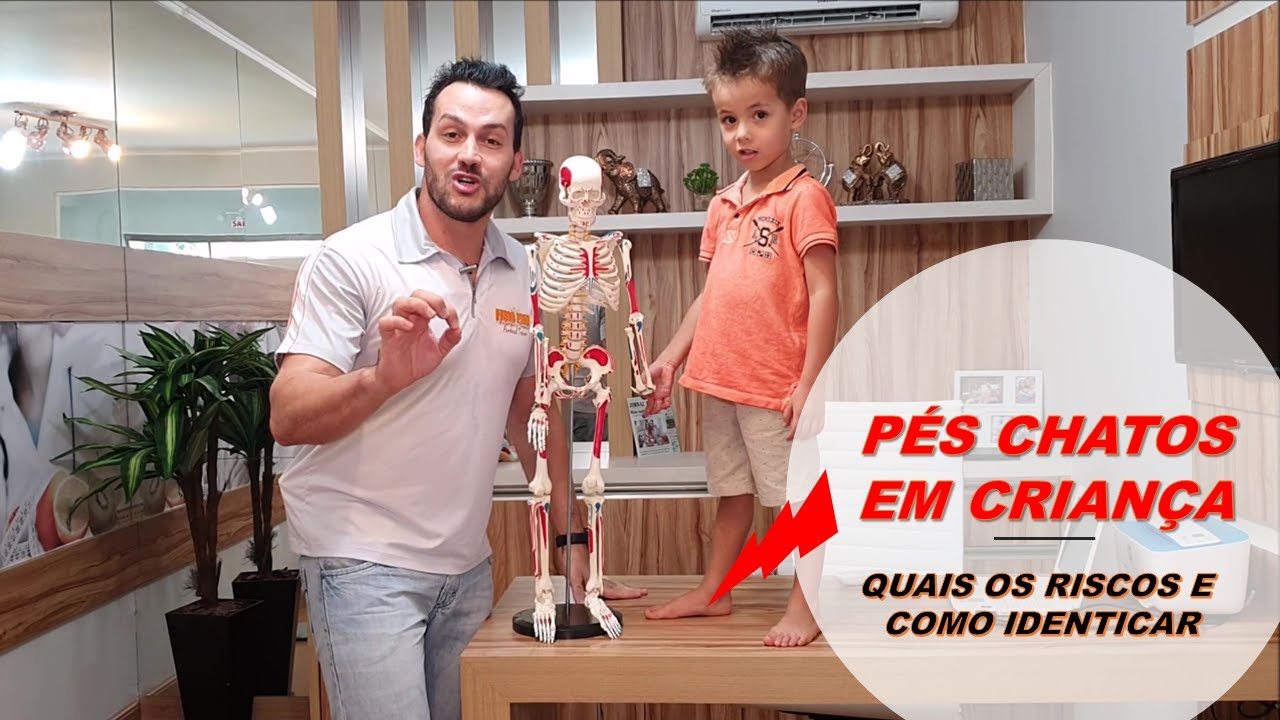 PÉS CHATOS O QUE FAZER A PARTIR DOS 3 ANOS