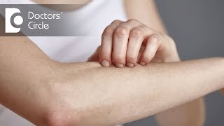 What causes rash on forearm and nose with its management? - Dr. Rashmi Ravindra