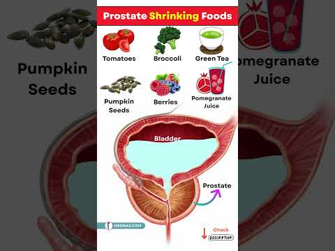 Men, Don’t Ignore This! Top 10 Prostate Friendly Foods