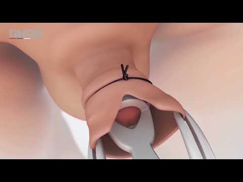 Cum să antrenezi mușchiul penisului
