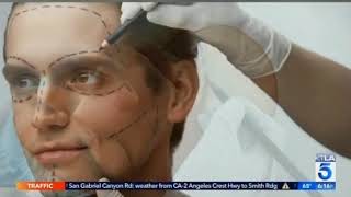 Rady Rahban, MD