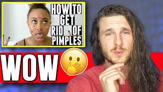 How To Get Rid of Pimples OVERNIGHT | REACTION