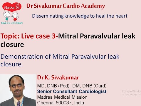3/11 Live case 3 : Mitral Paravalvular leak closure