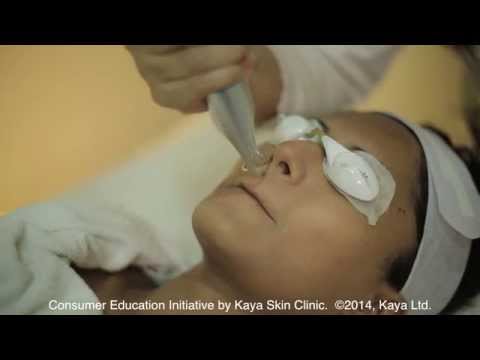 download lagu mp3 mp4 Kaya 360 Acne Treatment Cost, download lagu Kaya 360 Acne Treatment Cost gratis, unduh video klip Kaya 360 Acne Treatment Cost