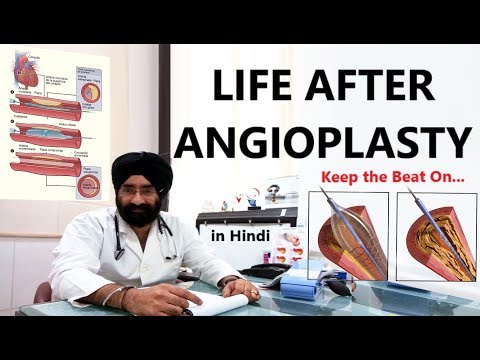 Rx Heart epi 15 h :Prevent 2nd Heart Attack (HIN) Lifestyle changes after ANGIOPLASTY | Dr.EDUCATION Video