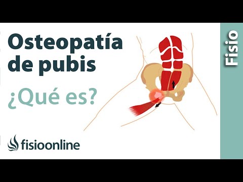 download lagu mp3 mp4 Hueso Pubico, download lagu Hueso Pubico gratis, unduh video klip Hueso Pubico