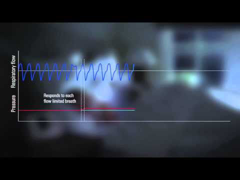 AirSense™ 10 AutoSet™ for Her for women with sleep apnea