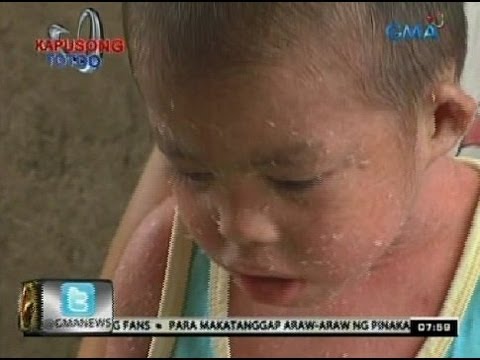 Mawalan ng Timbang sa roller ng video tuwalya Game Fiona loses timbang