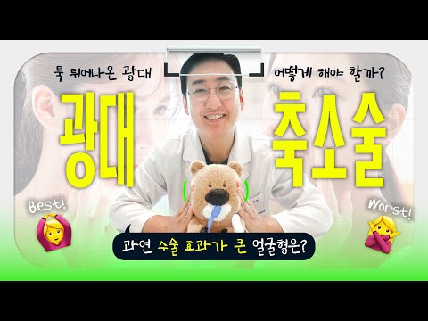 광대축소술의 효과가 큰 얼굴형은? 광대축소술의 모든 것!