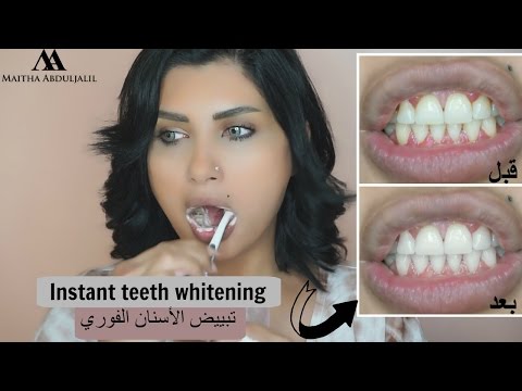 Instant whiter teeth remedy!  ❣❣ وصفة سحرية لتبييض الأسنان فور استخدامها