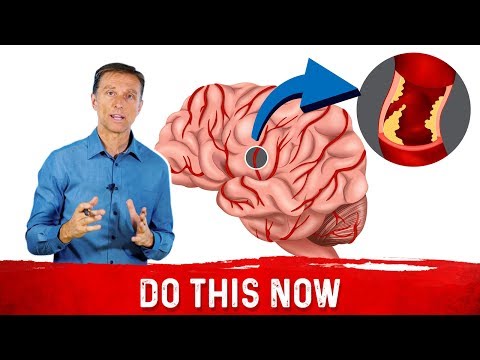 Weird Symptoms Explained by Dr Berg