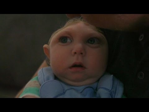 , title : ''Miracle Baby' Born Without Most of His Brain Defying Odds | ABC News'