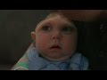 'Miracle Baby' Born Without Most of His Brain Defying Odds | ABC News - ABC News 'Miracle Baby' Born Without Most of His Brain Defying Odds | ABC News