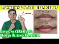 The Solution To Dark Lips Review Of The Best Lip Serum Thipank Lip Serum