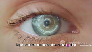 Fujifilm's AI Revolution: CAD EYEu00ae for Colonic Polyp Detection #MedicalAI #MedTech #futuretech