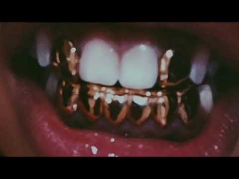 kidlovo - gold teeth ✨  (prod. $upreme)
