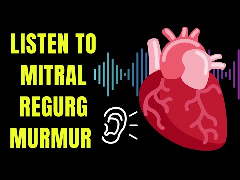 Listen to a Mitral Regurgitation heart murmur - and learn about causes, symptoms and treatment!