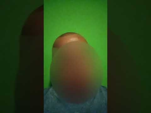 Ich habe Krämpfe am Genick bzw Augenkrämpfe und Fingerkrämpfe! weiß jemand woran es liegen könnte???