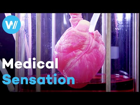 From Cardiac Arrest to the World's Fittest Man with a Donor Heart - The Heart that Defied Science