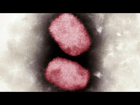 Mit Affenpocken Infizierte sollen für 21 Tage in Isolation | AFP