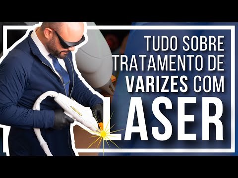 🔴 Tudo sobre o Tratamento de Varizes com LASER Transdérmico