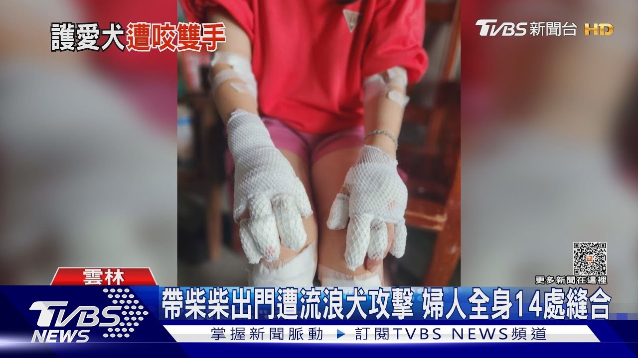 帶柴柴出門遭流浪犬攻擊 婦人全身14處縫合
