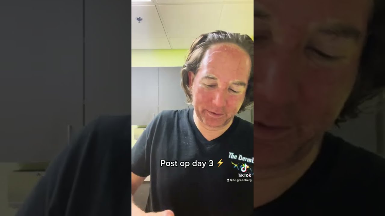 The Post CO2 Laser Treatment Healing Process at Las Vegas Dermatology Days 1-4