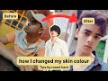How I Changed My Skin Colour Tips By Roomi Here