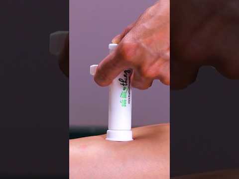 Say goodbye to itchy bug bites with this amazing device! #shorts