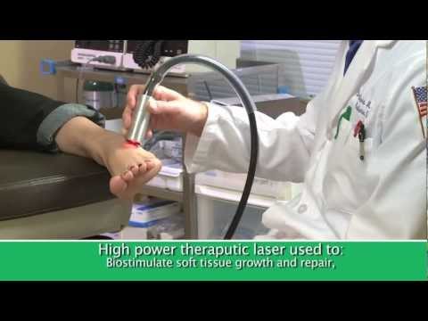 High Tech Laser Foot and Toenail Treatments